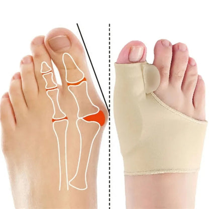 Orthomedy Orthopedic Daytime Bunion Sleeve