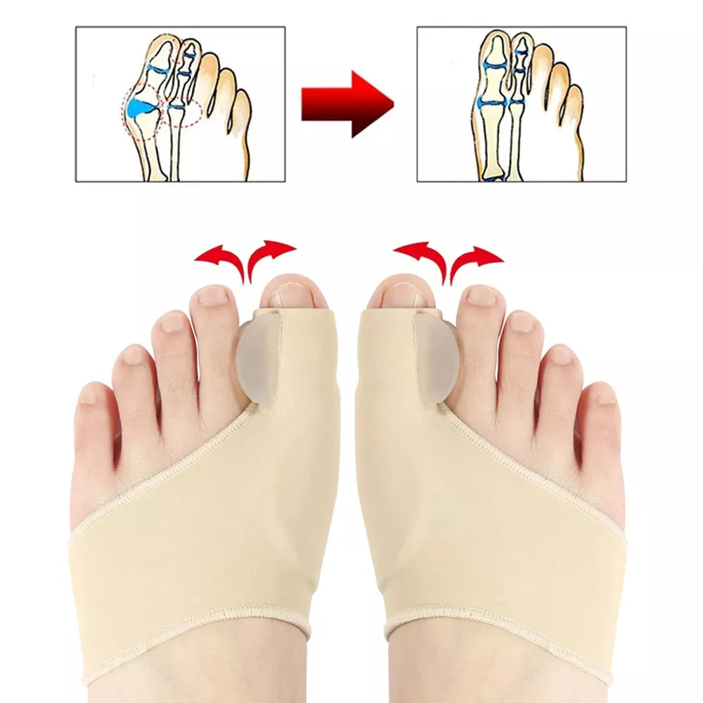 Orthomedy Orthopedic Daytime Bunion Sleeve