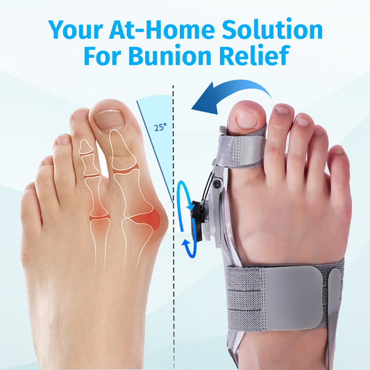 Orthomedy Bunion Fix - Natural At-Home Bunion Relief
