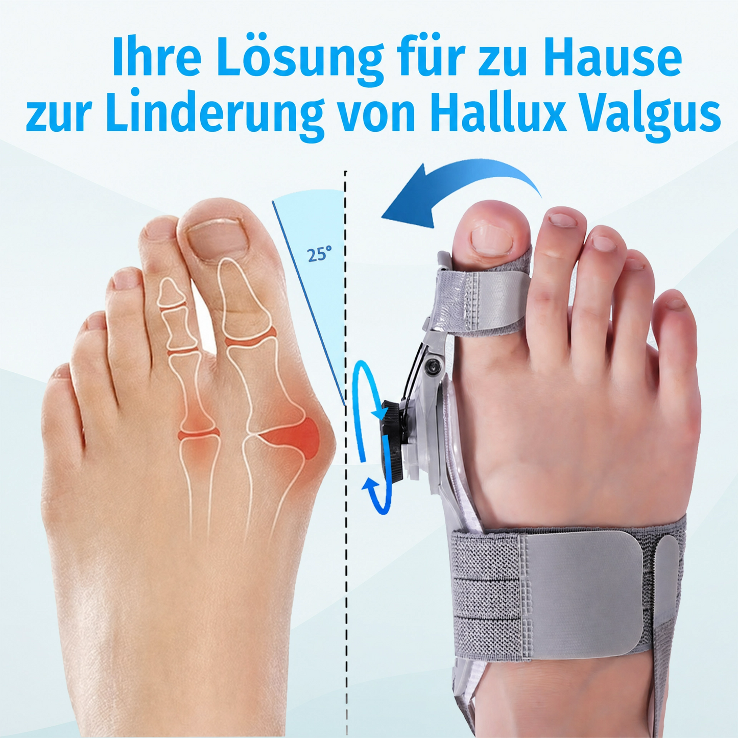 Orthomedy Bunion Fix - Natural At-Home Bunion Relief