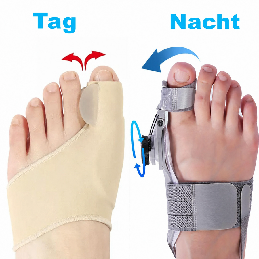Orthomedy Orthopedic Daytime Bunion Sleeve