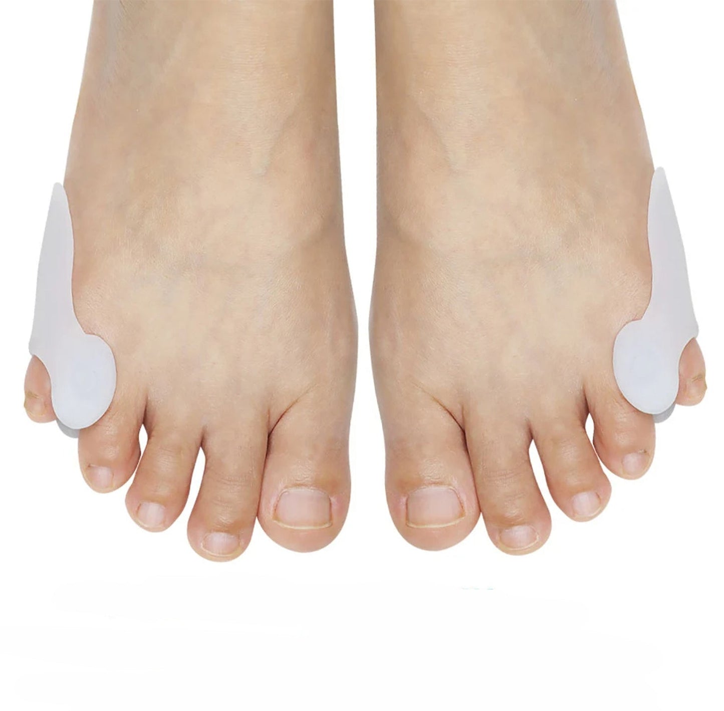Orthomedy Tailor's Bunion Fix